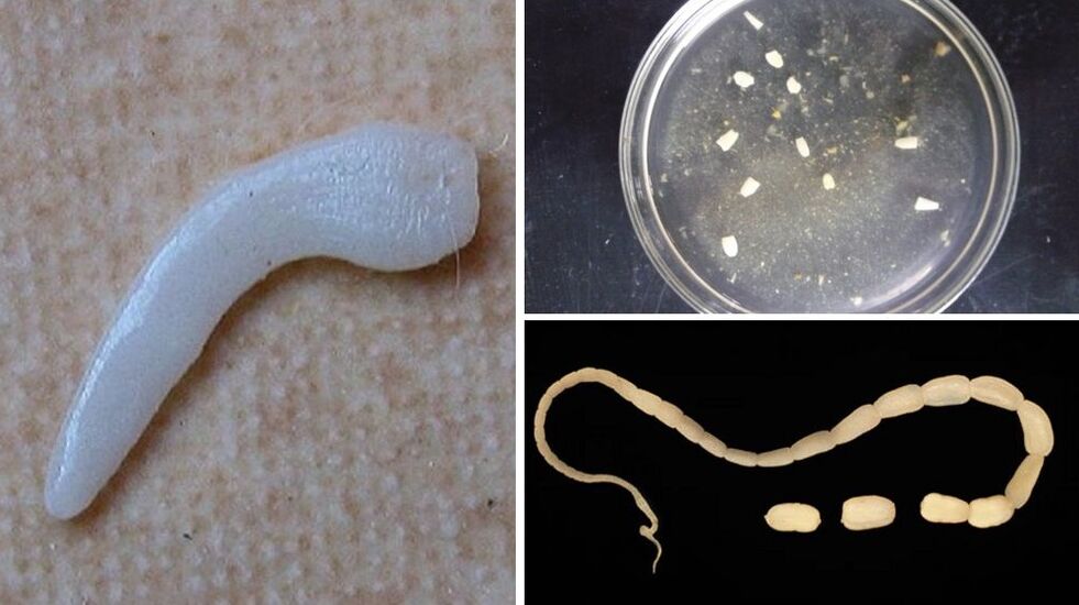 Parasites under the skin in humans symptoms, how to get rid of worms